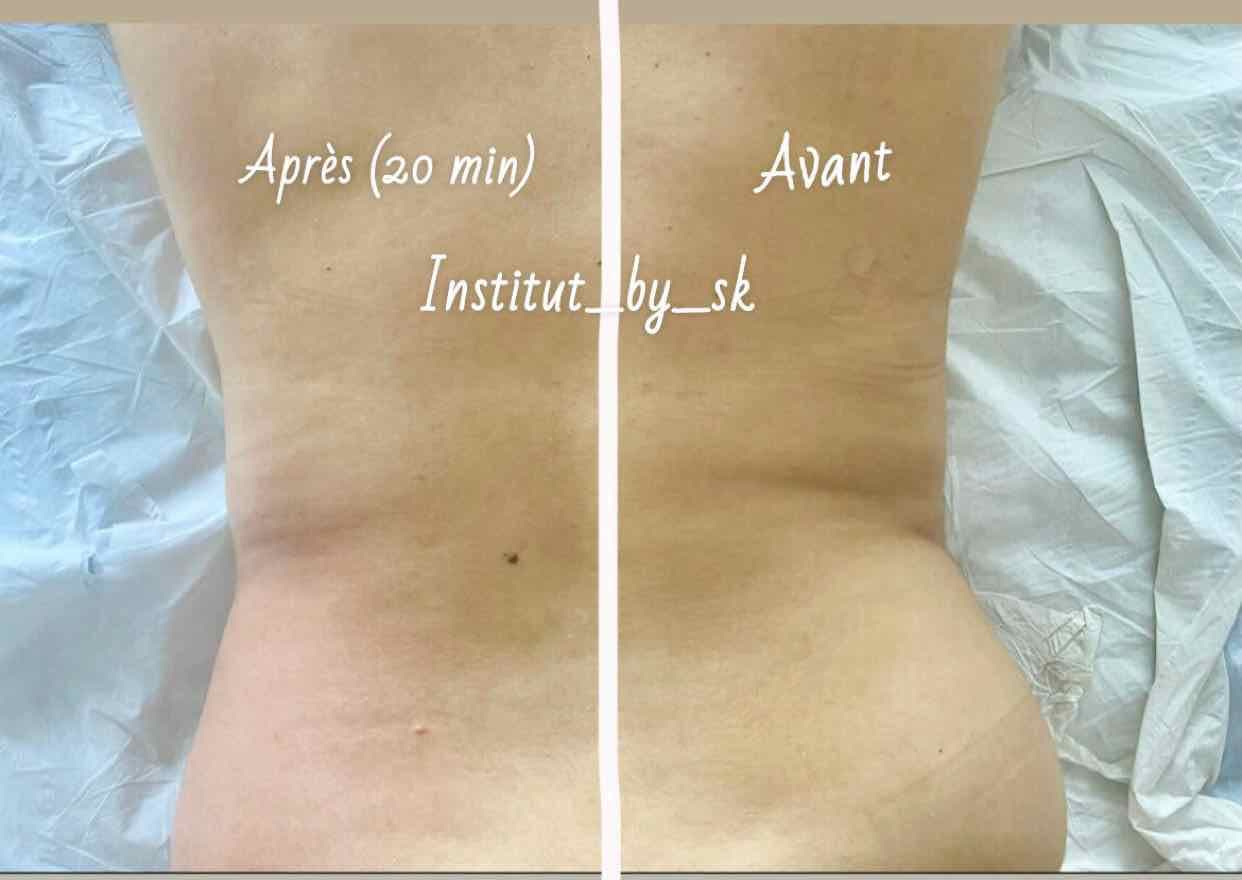 Maderotherpie corps — La madérothérapie : un soin naturel pour sublimer votre corps
La madérothérapie est une technique de massage réalisée 